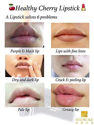 אגדה גיל בריאות יופי שפתיים מסכת 3 ב 1 קסום דובדבן שפתון אלף צבעים