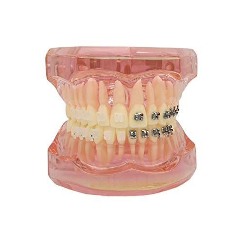 Dentalmall שיניים שיניים שיניים לימוד דגם עם סוגר קרמיקה מתכתית M3003