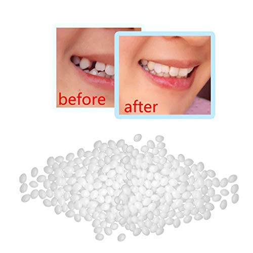 וערכה דבק דבק FASETEETH פערי שיניים תותבת שיניים דבק זמניות מוצקות הביתה שן שיניים רגישות
