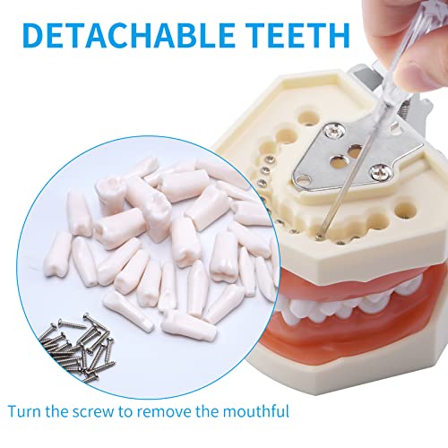 מודל שיניים סטנדרטי, מודל לימוד שיניים נשלף, מודל לימוד שיניים לימוד שיניים עם דגם שיניים עם מברג קטן