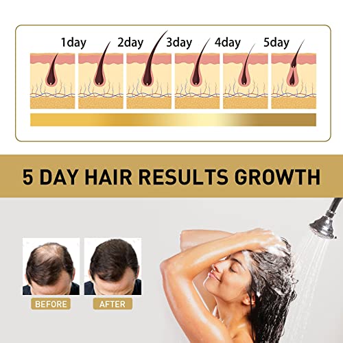 מוצרי שיער לגידול שיער פגום יבש עיבוי אובדן שיער שיער מהיר יותר ושמפו גדילה מלא יותר שיער 100