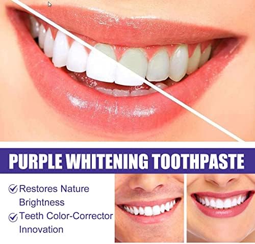 הלבנת שיניים משחת שיניים אפיית משחת שיניים מלבנת קצף משחת שיניים קצף אולטרה -אפין מנקה חניכיים