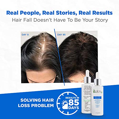 סרום שיער בתאי גזע זקיקים לגברים ולנשים, מחזור שלם עם אלוורה, ביוטין, רדנסיל, קפיקסיל והירספה, סרום לטיפול בשיער