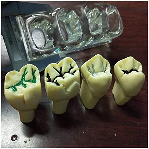 מודל ההוראה של RRGJ, מודל שיני שיניים אנטומיות - מודל סגירת סולקוס שיניים - שיניים נגד תולעת
